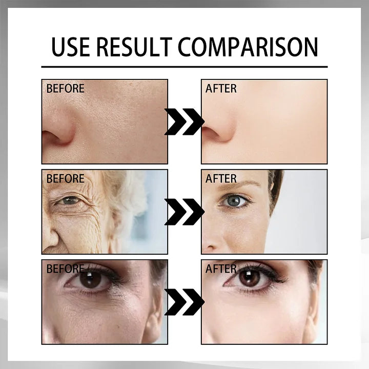 Snail Collagen Lifting Firming Cream🎁Buy 1 Get 1 Free (2Pcs)🎁